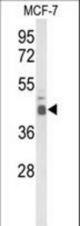 Western blot of ELF3 Antibody in MCF-7 cell line lysates (35 ug/lane). ELF3 (arrow) was detected using the purified antibody.