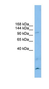CLSTN3 antibody LS-C116335 Western blot of RPMI-8226 cell lysate.