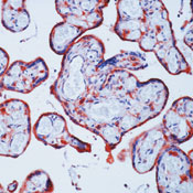 Formalin-fixed, paraffin-embedded human placenta stained with peroxidase-conjugate and AEC chromogen. Note cytoplasmic staining of trophoblasts.