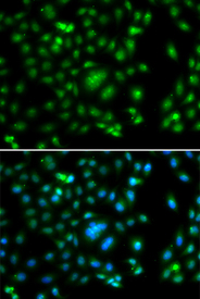 Immunofluorescence blot of A549 cell using ELF5 antibody. Blue: DAPI for nuclear staining.