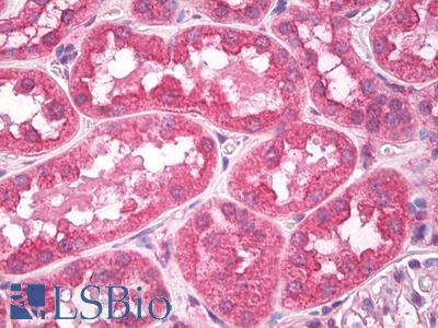 Anti-CLTA / CLTB antibody IHC of human kidney, tubules. Immunohistochemistry of formalin-fixed, paraffin-embedded tissue after heat-induced antigen retrieval. Antibody LS-B8521 dilution 5 ug/ml.