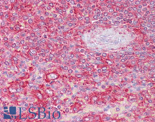 Anti-CLTA/CLTB antibody IHC of human spleen. Immunohistochemistry of formalin-fixed, paraffin-embedded tissue after heat-induced antigen retrieval. Antibody LS-B6480 concentration 2.5 ug/ml.