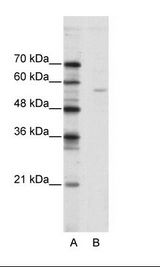 A: Marker, B: Jurkat Cell Lysate