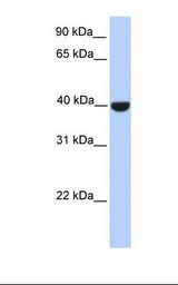 Fetal brain lysate. Antibody concentration: 1.0 ug/ml. Gel concentration: 12%.