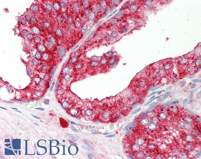 Human Prostate: Formalin-Fixed, Paraffin-Embedded (FFPE)