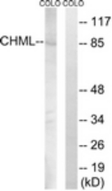 Western blot of extracts from COLO cells, using CHML Antibody. The lane on the right is treated with the synthesized peptide.