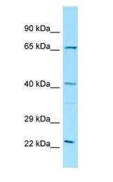 ELK3 / NET antibody Western Blot of Rat Thymus.