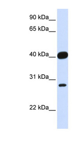 ELK3 / NET antibody LS-C102855 Western blot of Fetal Heart lysate.