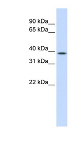 ELK3 / NET antibody LS-C102854 Western blot of Fetal Liver lysate.