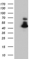 HEK293T cells were transfected with the pCMV6-ENTRY control (Left lane) or pCMV6-ENTRY ELK3 (Right lane) cDNA for 48 hrs and lysed. Equivalent amounts of cell lysates (5 ug per lane) were separated by SDS-PAGE and immunoblotted with anti-ELK3.
