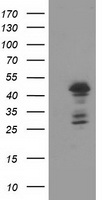 HEK293T cells were transfected with the pCMV6-ENTRY control (Left lane) or pCMV6-ENTRY ELK3 (Right lane) cDNA for 48 hrs and lysed. Equivalent amounts of cell lysates (5 ug per lane) were separated by SDS-PAGE and immunoblotted with anti-ELK3.