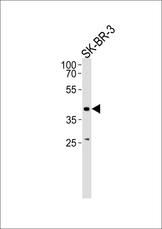 ELK3 Antibody western blot of SK-BR-3 cell line lysates (35 ug/lane). The ELK3 antibody detected the ELK3 protein (arrow).