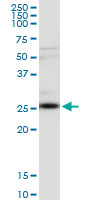 CLTA monoclonal antibody (M08), clone 4E9. Western Blot analysis of CLTA expression in human kidney.