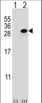 Western blot of CLTA (arrow) using rabbit polyclonal CLTA Antibody. 293 cell lysates (2 ug/lane) either nontransfected (Lane 1) or transiently transfected (Lane 2) with the CLTA gene.