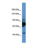 Western blot of Human Fetal Brain. ERC1 antibody dilution 1.0 ug/ml.