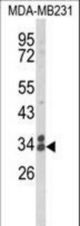 Western blot of CLTA Antibody in MDA-MB231 cell line lysates (35 ug/lane). CLTA (arrow) was detected using the purified antibody.