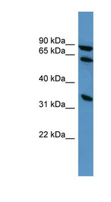 ELMO1 antibody LS-C135573 Western blot of HepG2 cell lysate.