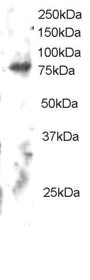 Antibody staining (2 ug/ml) of Human Brain lysate (RIPA buffer, 30 ug total protein per lane). Primary incubated for 12 hour. Detected by Western blot of chemiluminescence.