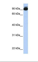 721_B cell lysate. Antibody concentration: 1.0 ug/ml. Gel concentration: 12%.