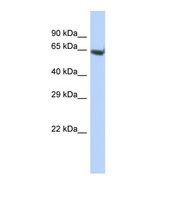 Western blot of Human Liver tumor. ELMO3 antibody dilution 1.0 ug/ml.