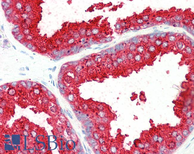 Anti-ELMO3 antibody IHC staining of human prostate. Immunohistochemistry of formalin-fixed, paraffin-embedded tissue after heat-induced antigen retrieval. Antibody LS-B10271 concentration 5 ug/ml.