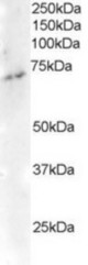 Antibody staining (2 ug/ml) of Human Brain lysate (RIPA buffer, 35 ug total protein per lane). Primary incubated for 1 hour. Detected by Western blot of chemiluminescence.
