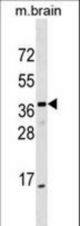 ELMOD1 Antibody western blot of mouse brain tissue lysates (35 ug/lane). The ELMOD1 antibody detected the ELMOD1 protein (arrow).