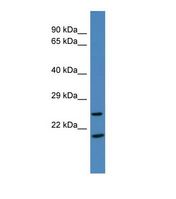Western blot of Human COLO205. ELMOD1 antibody dilution 1.0 ug/ml.
