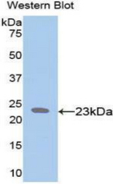 Western blot of recombinant ELN / Elastin.