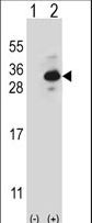 Western blot of CLTB (arrow) using rabbit polyclonal CLTB Antibody. 293 cell lysates (2 ug/lane) either nontransfected (Lane 1) or transiently transfected (Lane 2) with the CLTB gene.