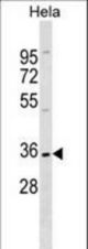 ELOVL1 Antibody western blot of HeLa cell line lysates (35 ug/lane). The ELOVL1 antibody detected the ELOVL1 protein (arrow).