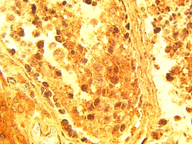 IHC of normal human testis tissue using ELOV4 antibody (LS-C140625) at 15 ug/ml.