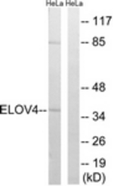 Western blot of extracts from HeLa cells, using ELOVL4 Antibody. The lane on the right is treated with the synthesized peptide.