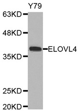 Western blot analysis of extracts of Y79 cell line, using ELOVL4 antibody.