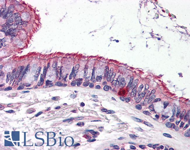 Anti-ELOVL6 antibody IHC of human lung. Immunohistochemistry of formalin-fixed, paraffin-embedded tissue after heat-induced antigen retrieval. Antibody LS-B2710 concentration 5 ug/ml.