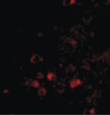 Immunofluorescence of ELOVL6 in Human Brain cells with ELOVL6 antibody at 20 ug/ml.