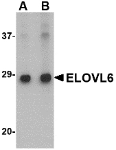 Western blot of ELOVL6 in Human brain tissue lysate with ELOVL6 antibody at (A) 1 and (B) 2 ug/ml.