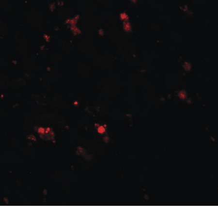Immunofluorescence of ELOVL7 in human liver tissue with ELOVL7 antibody at 20 ug/ml.