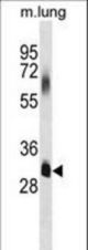 ELOVL7 Antibody western blot of mouse lung tissue lysates (35 ug/lane). The ELOVL7 antibody detected the ELOVL7 protein (arrow).