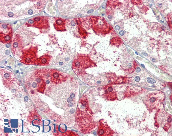 Anti-CLTC antibody IHC of human kidney. Immunohistochemistry of formalin-fixed, paraffin-embedded tissue after heat-induced antigen retrieval. Antibody LS-B4174 concentration 3.75 ug/ml.