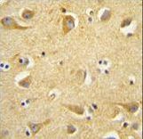 CLTC antibody immunohistochemistry of formalin-fixed and paraffin-embedded human brain tissue followed by peroxidase-conjugated secondary antibody and DAB staining.