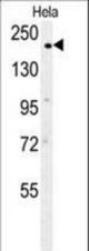 CLTC Antibody western blot of HeLa cell line lysates (35 ug/lane). The CLTC antibody detected the CLTC protein (arrow).
