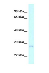 CHMP2A antibody LS-C145722 Western blot of 293T Cell lysate. Antibody concentration 1 ug/ml.