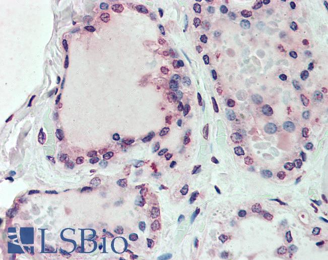 Anti-EMB antibody LS-A8839 IHC of human thyroid. Immunohistochemistry of formalin-fixed, paraffin-embedded tissue after heat-induced antigen retrieval.