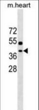 TTC35 Antibody western blot of mouse heart tissue lysates (35 ug/lane). The TTC35 Antibody detected the TTC35 protein (arrow).