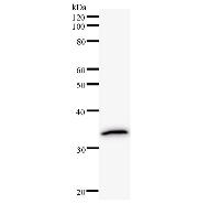 Western blot analysis of immunized recombinant protein, using anti-TTC35 monoclonal antibody.