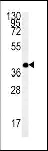 TM111 Antibody western blot of MDA-MB435 cell line lysates (35 ug/lane). The TM111 antibody detected the TM111 protein (arrow).