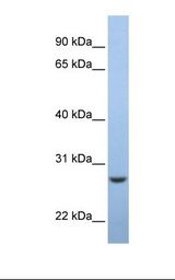 Fetal muscle lysate. Antibody concentration: 1.0 ug/ml. Gel concentration: 12%.