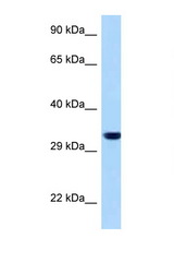 EMD / Emerin antibody LS-C146128 Western blot of MCF7 Cell lysate. Antibody concentration 1 ug/ml.