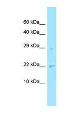 CHMP2A antibody LS-C146294 Western blot of Fetal Lung lysate. Antibody concentration 1 ug/ml.